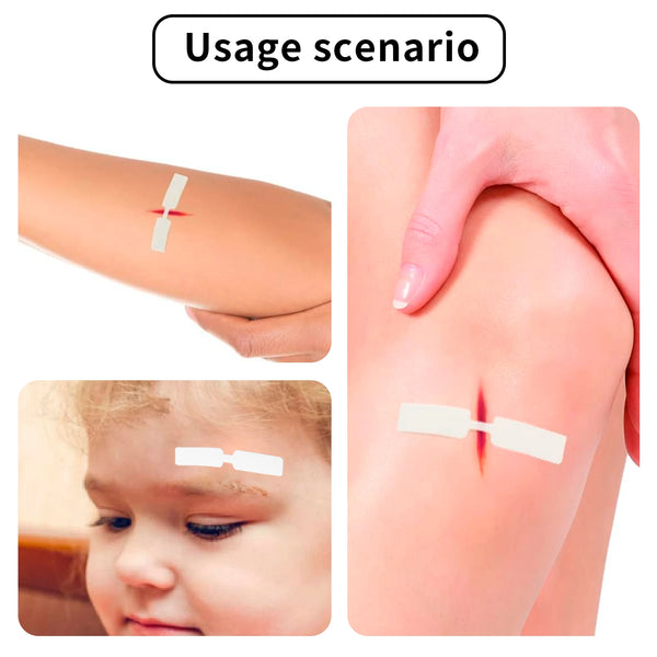 120-240PCS-1cmX4-5cm-Small-Waterproof-Band-Aid-Butterfly-Adhesive-Wound-Patch-Band-Aid-Emergency-kit.jpg